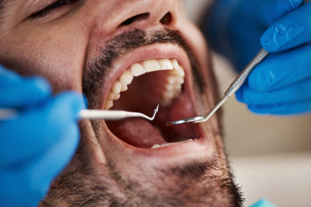 Best Broken or Cracked Tooth Emergency Dentist in Lukachukai, AZ